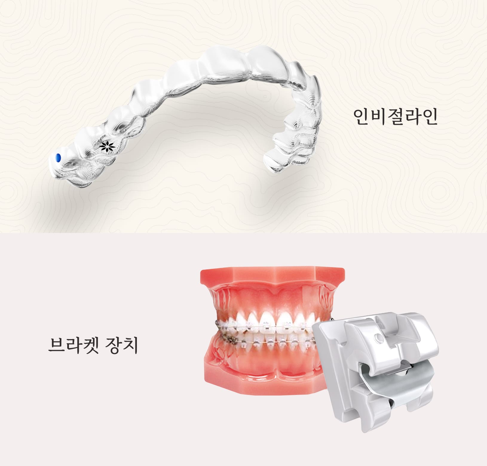 더스퀘어치과 | 장치별 치아교정 종류 투명교정